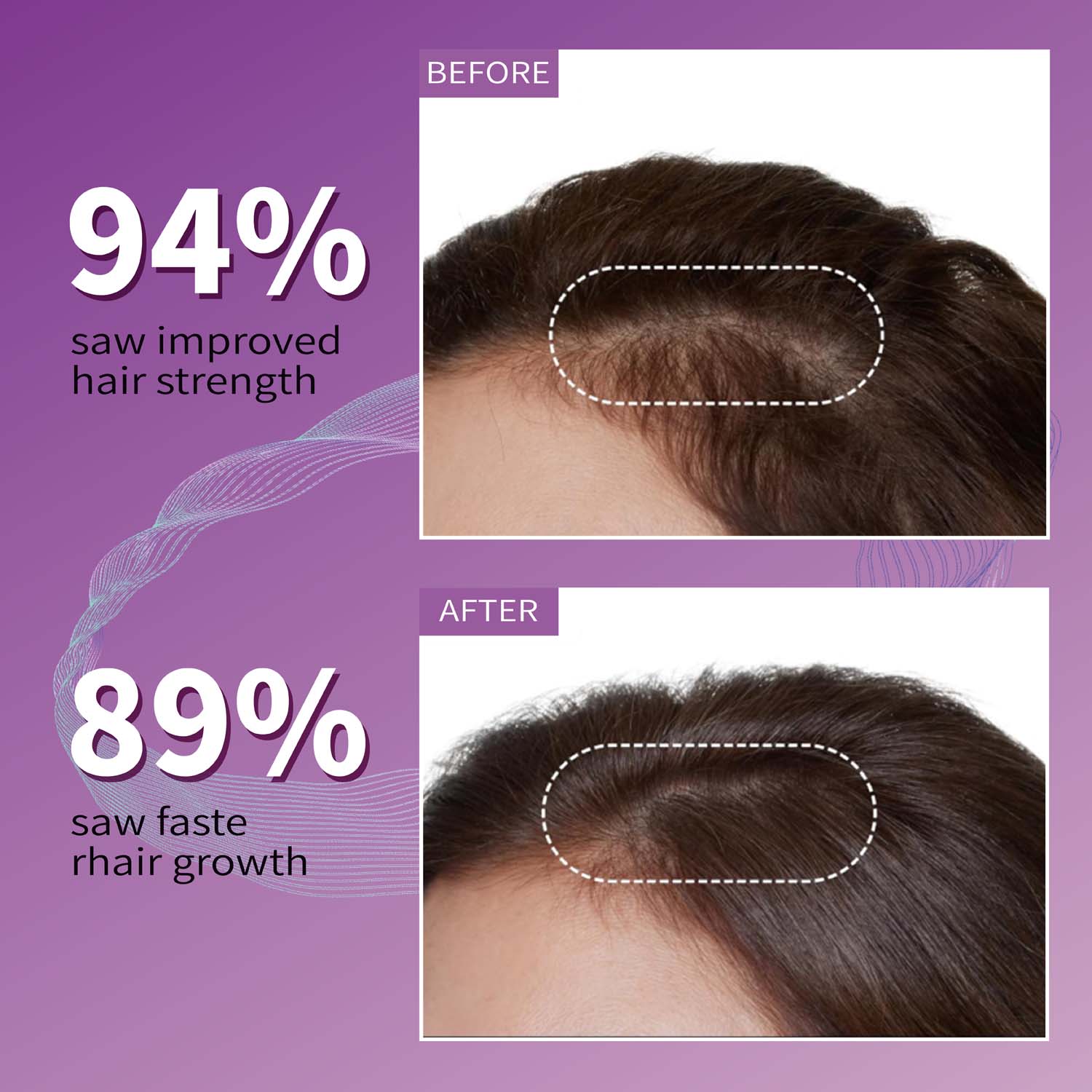 Biotin Gummies 5000 Mcg Hair S - Multivitamin Gummy Adult 评论和价格
